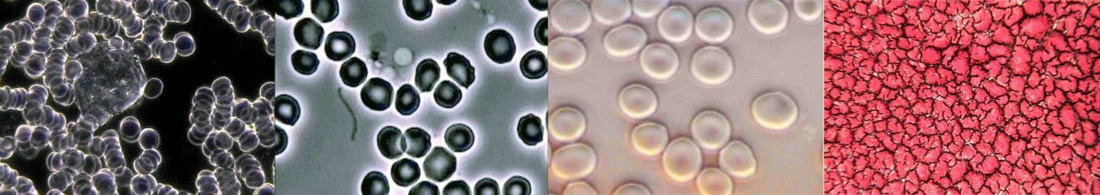 blood-group2-pic