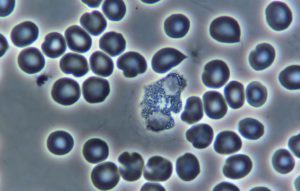 Phase Contrast