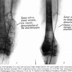 vo2t-arteriograph