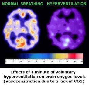 vo2t-hypervent vo2t-hypervent